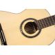 ORTEGA PERFORMER SERIES, SPRUCE R158